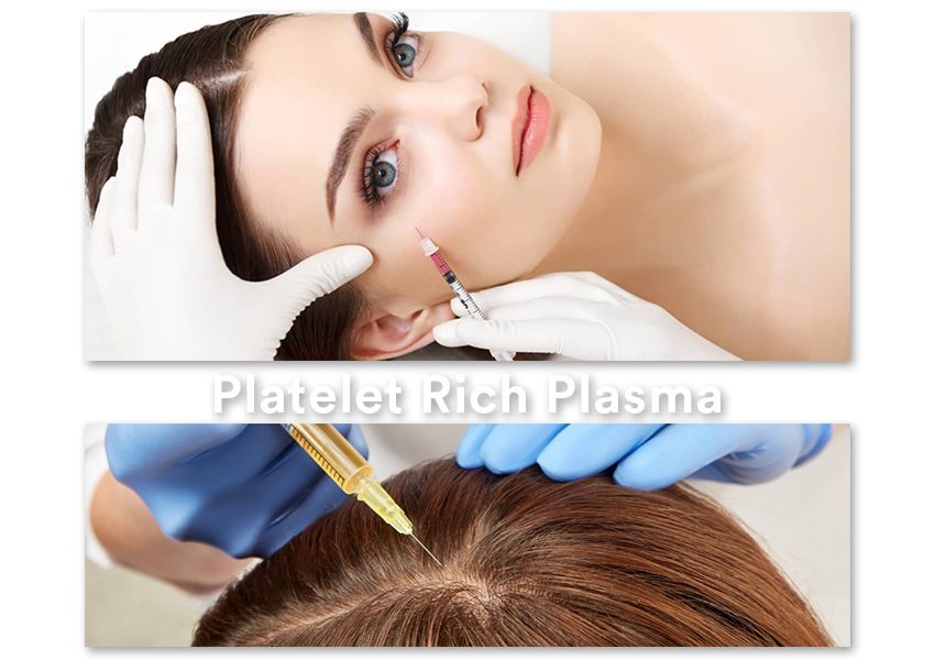 Platelet Rich Plasma Treatment in Chennai || Dr. Lavanya Skin & Hair Clinic